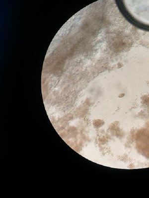 Chagoi Willi +Mikroskop 2017-07-24 021.jpg