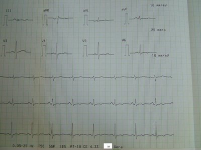 EKG_81.jpg