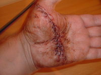 Hand2468.JPG