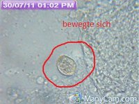 Abstrich Anne 30-07 was ist das 2.jpg